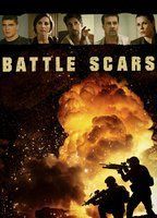Battle Scars