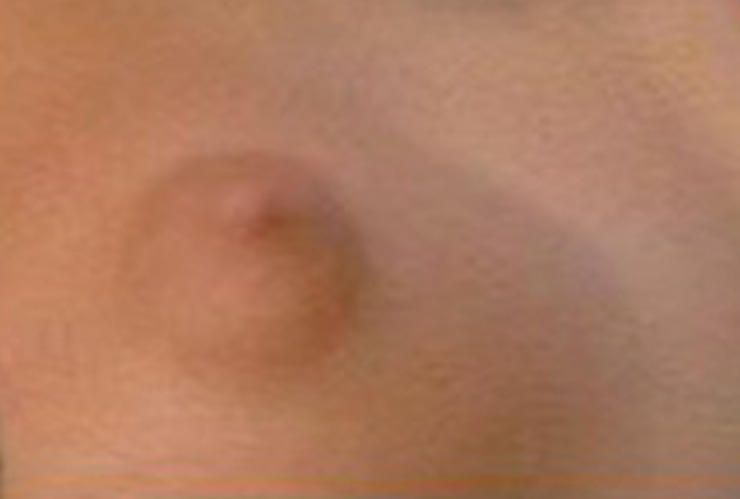 Guess That Celebrity Nipple 1032017 
