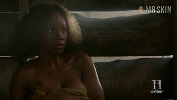 Noni bikini anika rose Emmys: More